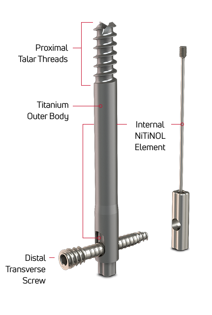 DynaNail Hybrid Features