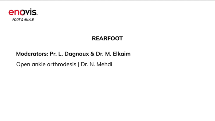 Open Ankle Arthrodesis - Dr Mehdi