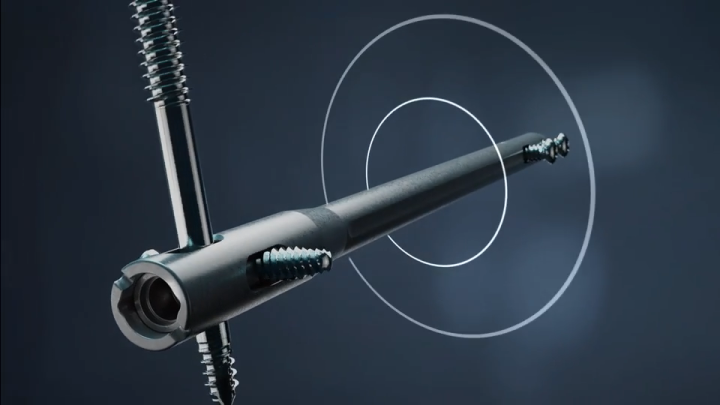 dynanail nitinol animation