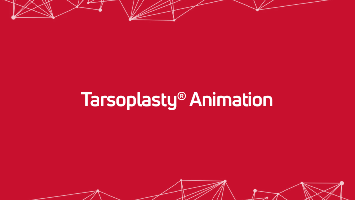 Tarsoplasty Animation