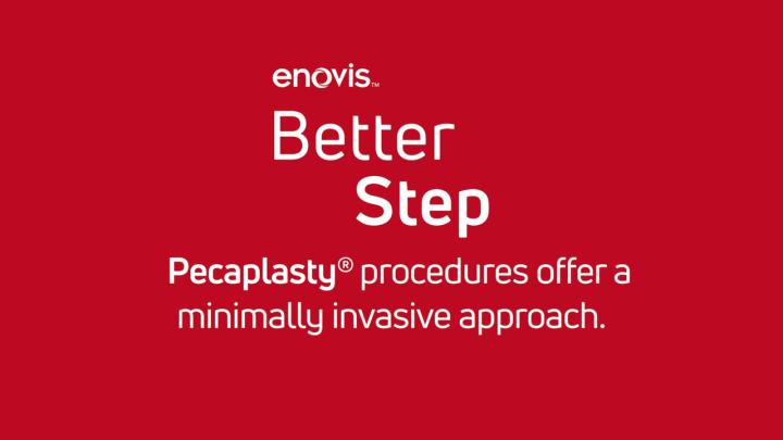 BetterStep - Pecaplasty