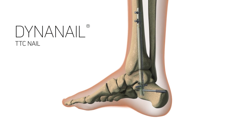 DynaNail TTC Animation