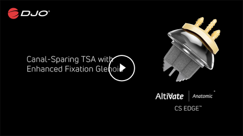 AltiVate® Anatomic CS EDGE® | Live Surgery with Dr. Edwin Spencer